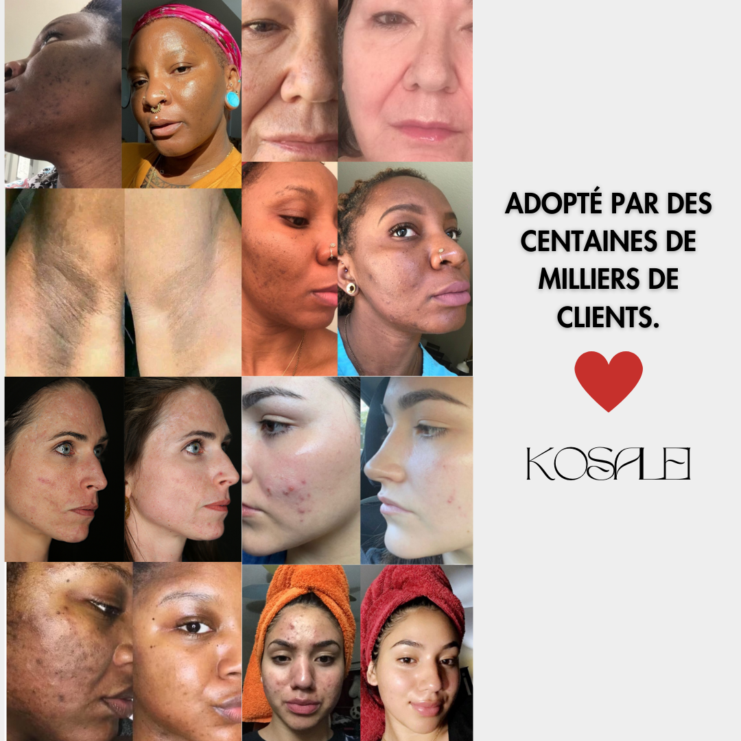 Cotons Glow Up – Anti-taches Curcuma & Acide Kojique
