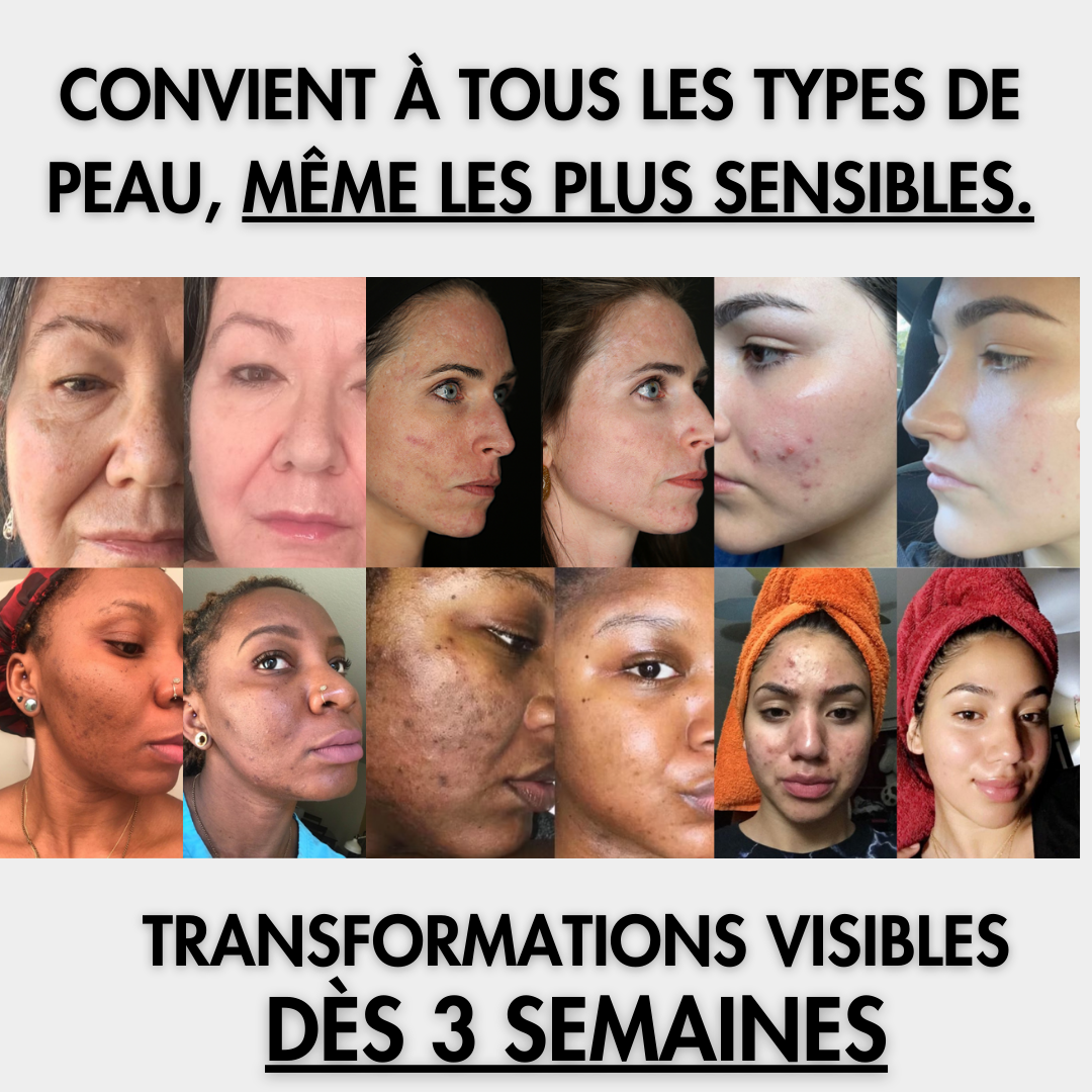 Cotons Glow Up – Anti-taches Curcuma & Acide Kojique