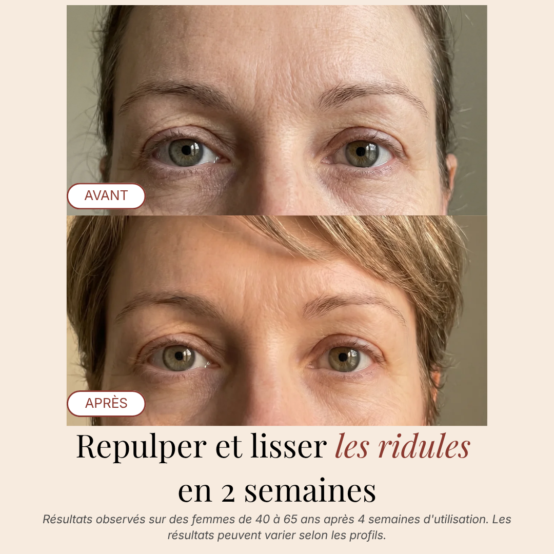 Patchs Yeux InstaLift au PDRN & Collagène