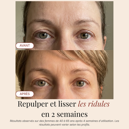 Patchs Yeux InstaLift au PDRN & Collagène