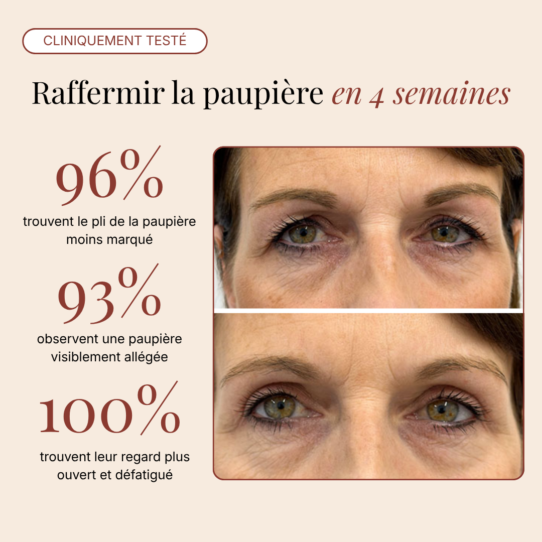 Patchs Yeux InstaLift au PDRN & Collagène