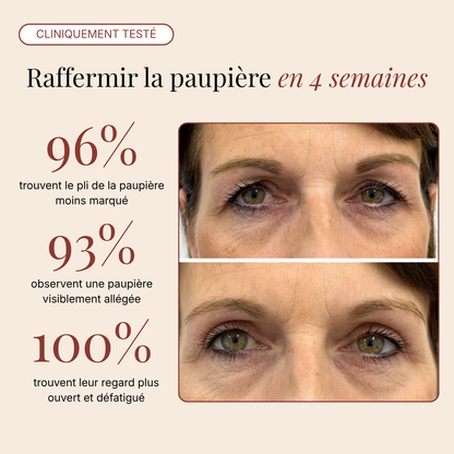 Patchs Yeux InstaLift au PDRN & Collagène