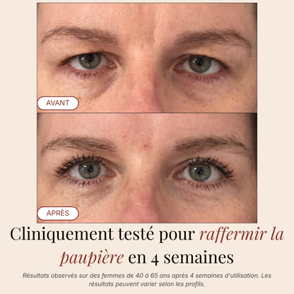 Patchs Yeux InstaLift au PDRN & Collagène