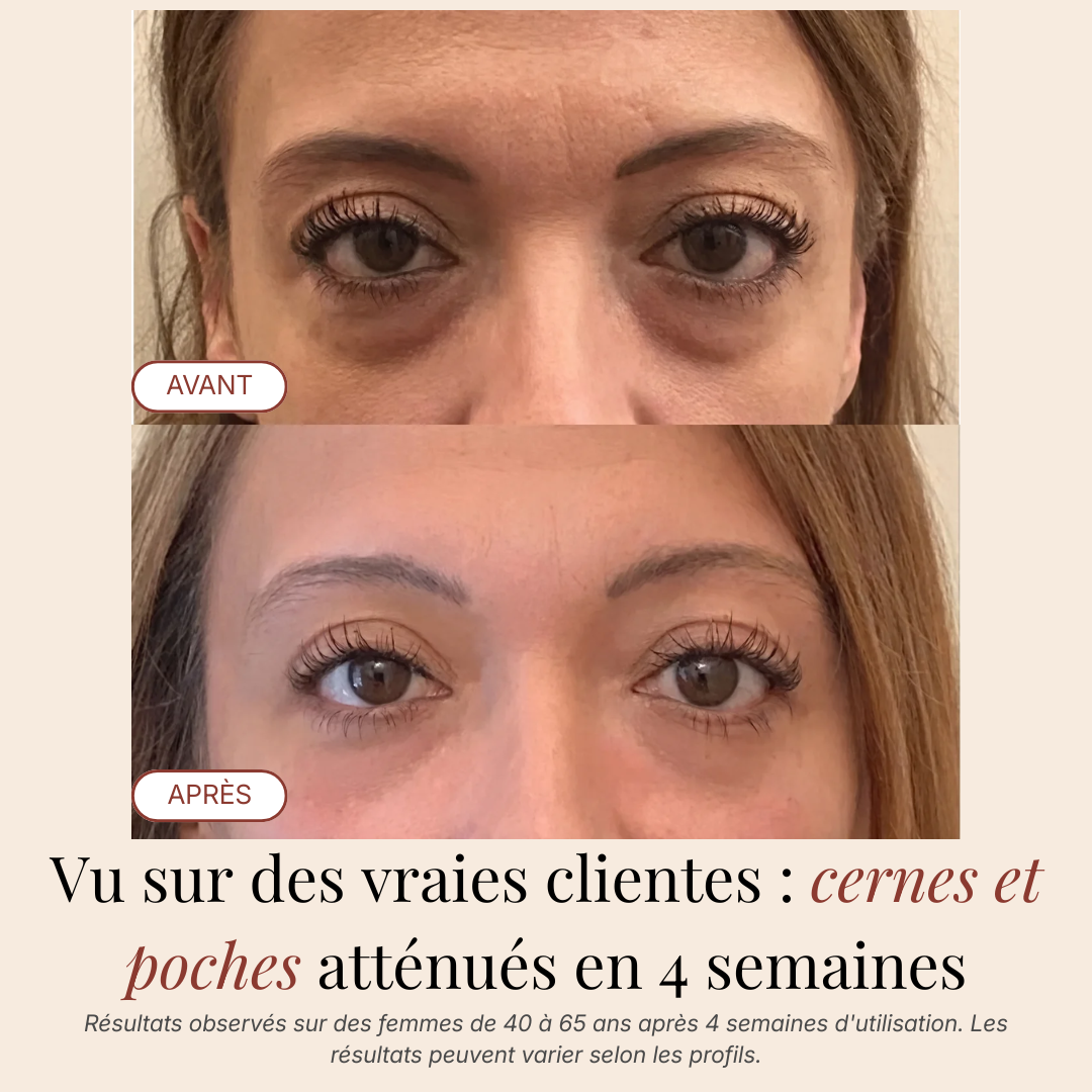 Patchs Yeux InstaLift au PDRN & Collagène