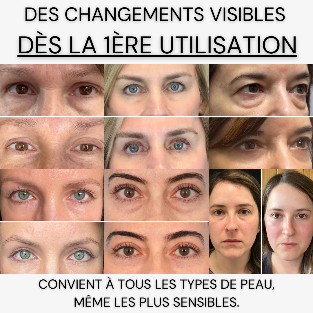 Patchs Yeux InstaLift au PDRN & Collagène