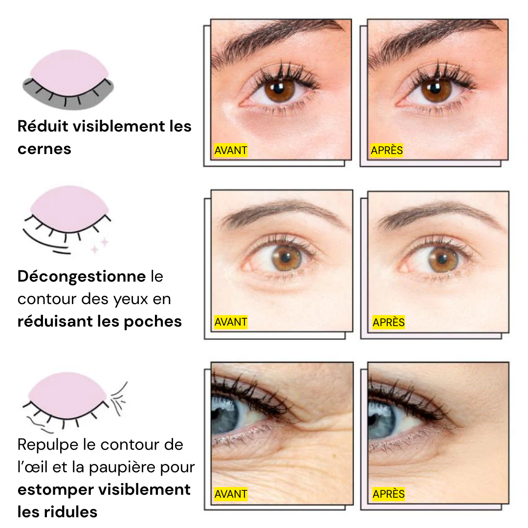 Patchs Yeux InstaLift au PDRN & Collagène