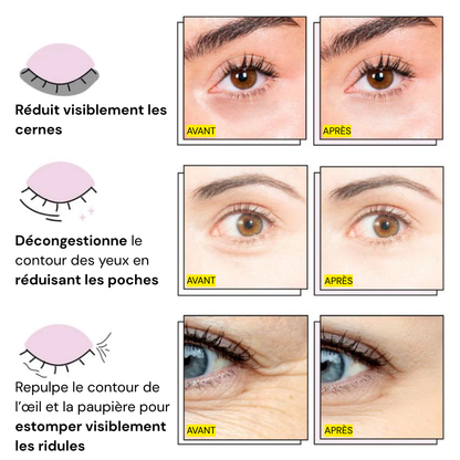 Patchs Yeux InstaLift au PDRN & Collagène